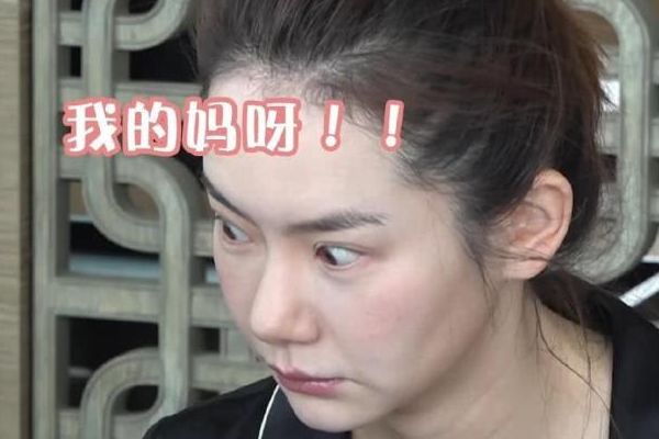 换头术最新进展，时代进步的神奇里程碑